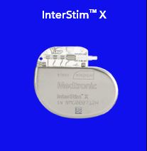 Interstim.jpg