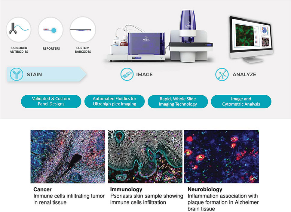 [MISSING IMAGE: ph_stainimageanalyze-4clr.jpg]
